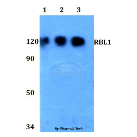 Anti-RBL1 Antibody from Bioworld Technology (BS60760) - Antibodies.com