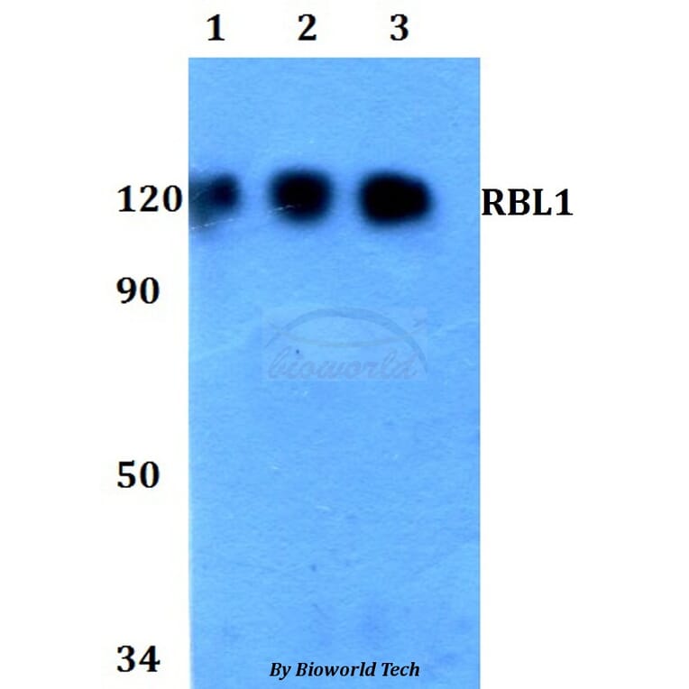 Anti-RBL1 Antibody from Bioworld Technology (BS60760) - Antibodies.com