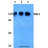 Anti-RBL1 Antibody from Bioworld Technology (BS60760) - Antibodies.com