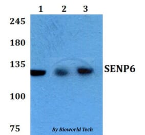 Anti-SENP6 Antibody from Bioworld Technology (BS60762) - Antibodies.com