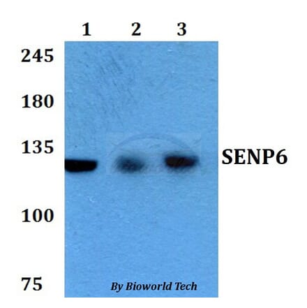 Anti-SENP6 Antibody from Bioworld Technology (BS60762) - Antibodies.com