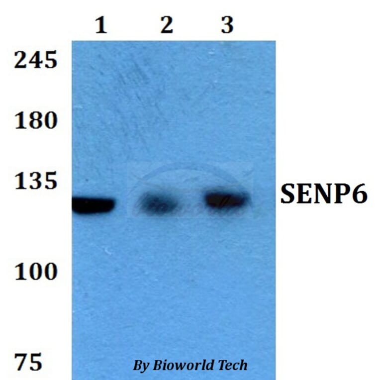 Anti-SENP6 Antibody from Bioworld Technology (BS60762) - Antibodies.com