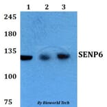 Anti-SENP6 Antibody from Bioworld Technology (BS60762) - Antibodies.com