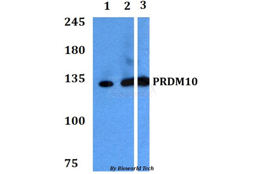 Anti-PRDM10 Antibody from Bioworld Technology (BS60764) - Antibodies.com