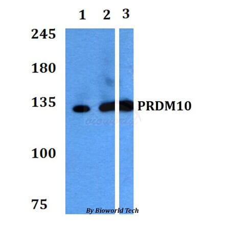 Anti-PRDM10 Antibody from Bioworld Technology (BS60764) - Antibodies.com