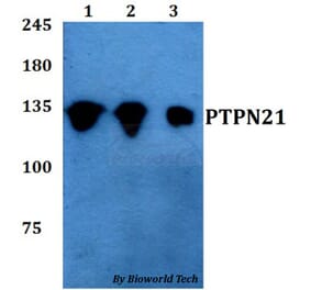 Anti-PTPN21 Antibody from Bioworld Technology (BS60767) - Antibodies.com