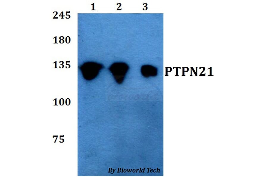 Anti-PTPN21 Antibody from Bioworld Technology (BS60767) - Antibodies.com