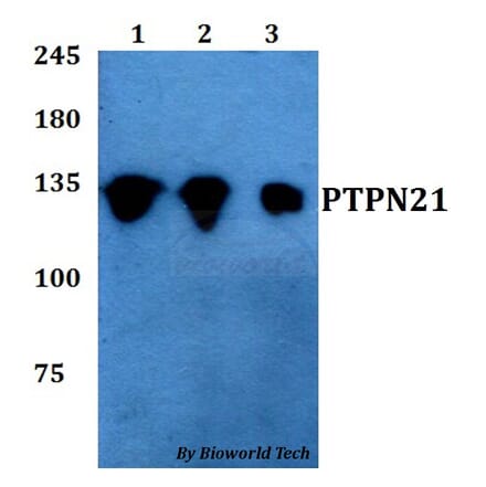 Anti-PTPN21 Antibody from Bioworld Technology (BS60767) - Antibodies.com