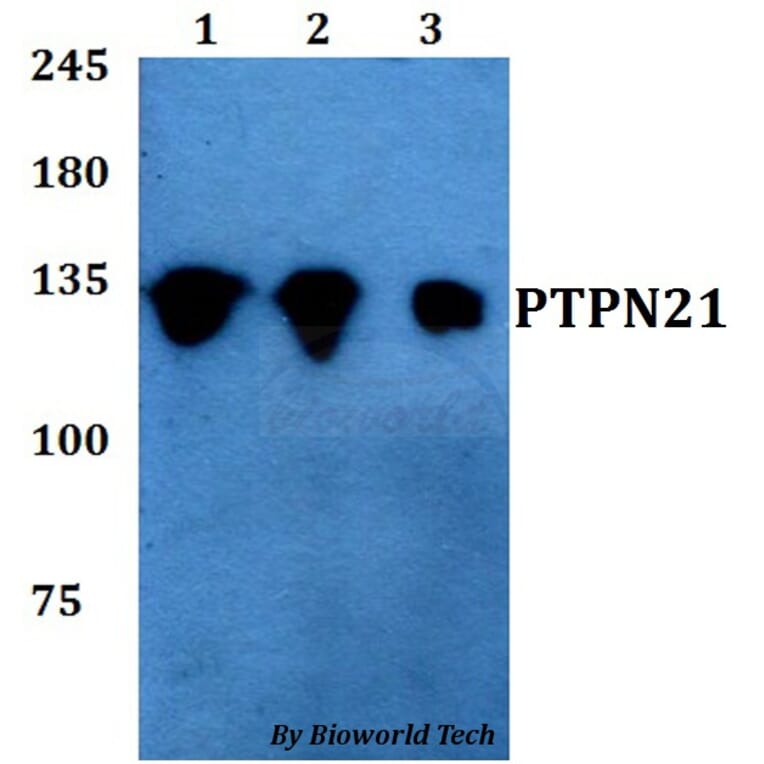 Anti-PTPN21 Antibody from Bioworld Technology (BS60767) - Antibodies.com