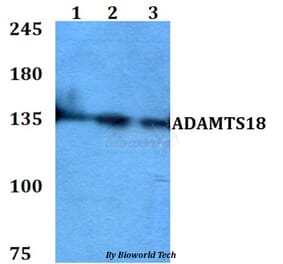 Anti-ADAMTS18 Antibody from Bioworld Technology (BS60769) - Antibodies.com