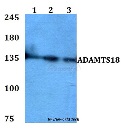 Anti-ADAMTS18 Antibody from Bioworld Technology (BS60769) - Antibodies.com