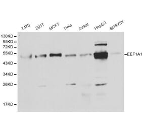 Anti-EEF1A1 Antibody from Bioworld Technology (BS6077) - Antibodies.com