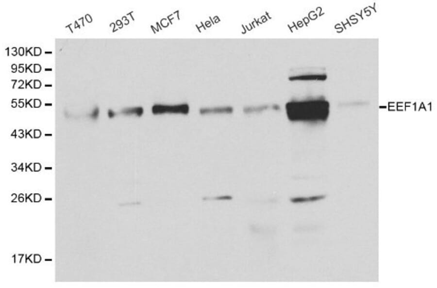 Anti-EEF1A1 Antibody from Bioworld Technology (BS6077) - Antibodies.com