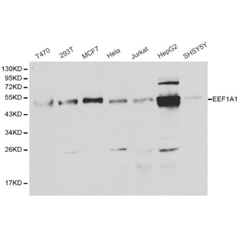 Anti-EEF1A1 Antibody from Bioworld Technology (BS6077) - Antibodies.com