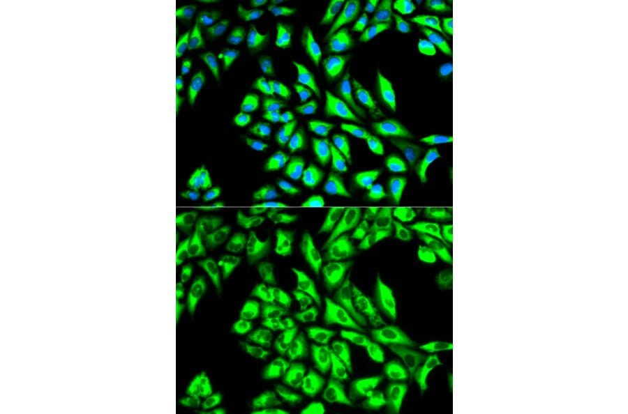 Anti-EEF1A1 Antibody from Bioworld Technology (BS6077) - Antibodies.com