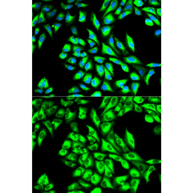 Anti-EEF1A1 Antibody from Bioworld Technology (BS6077) - Antibodies.com