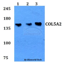 Anti-COL5A2 Antibody from Bioworld Technology (BS60774) - Antibodies.com