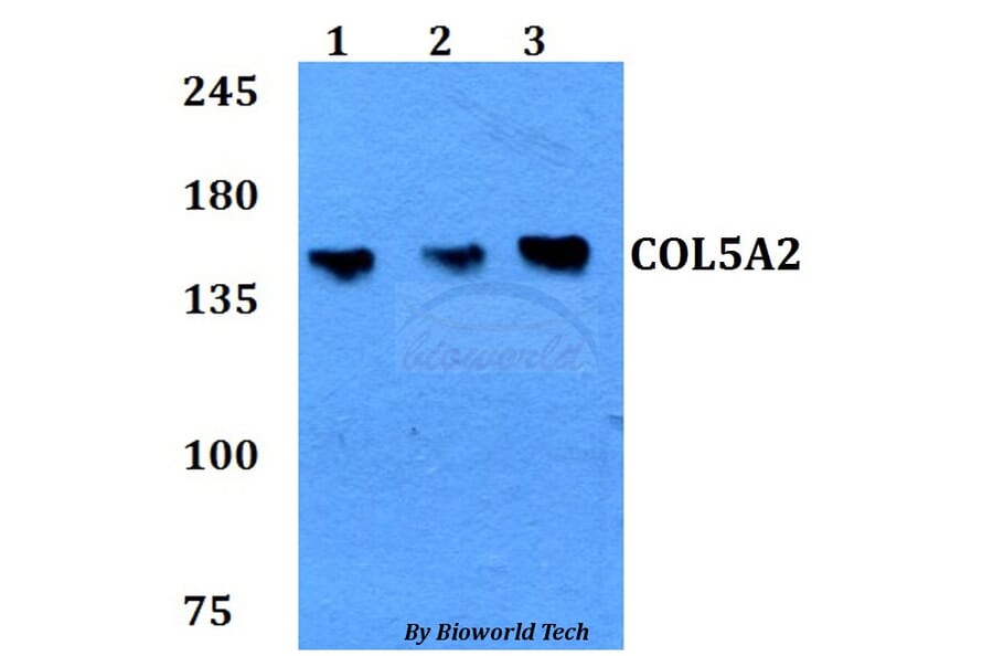 Anti-COL5A2 Antibody from Bioworld Technology (BS60774) - Antibodies.com