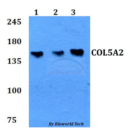 Anti-COL5A2 Antibody from Bioworld Technology (BS60774) - Antibodies.com
