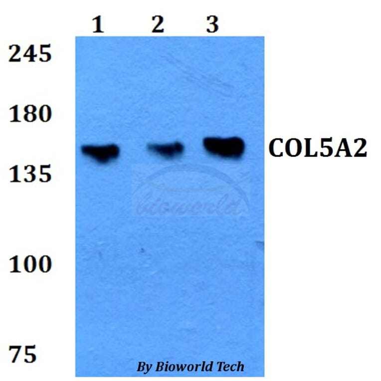 Anti-COL5A2 Antibody from Bioworld Technology (BS60774) - Antibodies.com