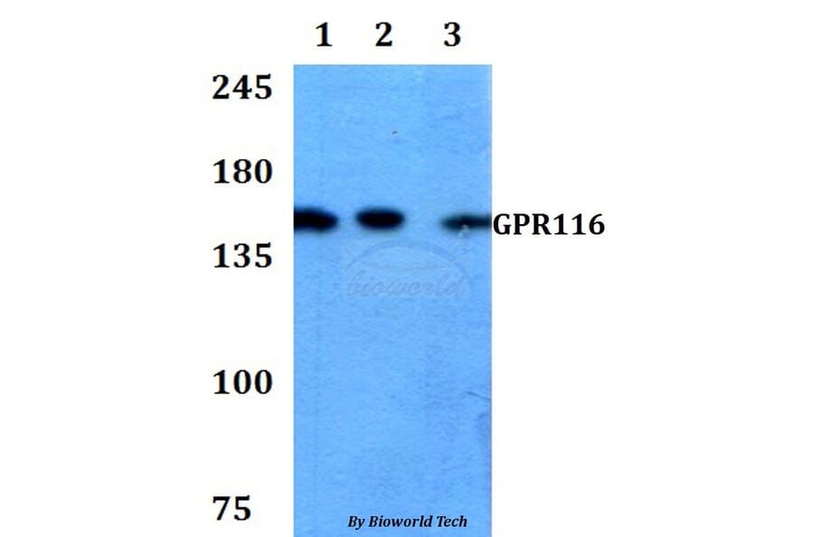 Anti-GPR116 Antibody from Bioworld Technology (BS60775) - Antibodies.com
