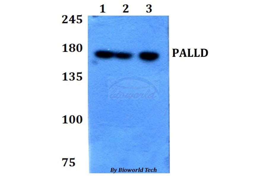 Anti-PALLD Antibody from Bioworld Technology (BS60777) - Antibodies.com