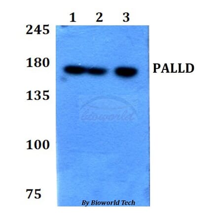 Anti-PALLD Antibody from Bioworld Technology (BS60777) - Antibodies.com