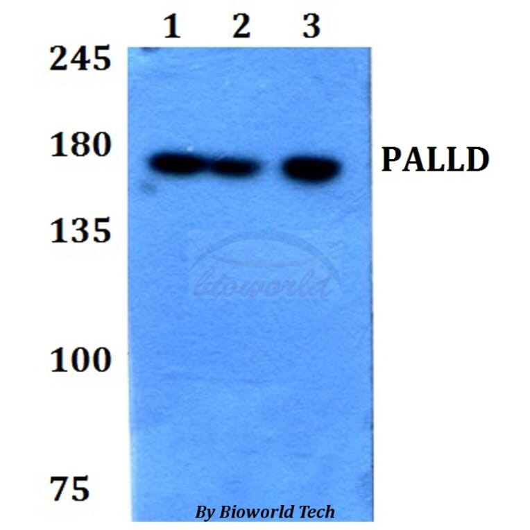 Anti-PALLD Antibody from Bioworld Technology (BS60777) - Antibodies.com