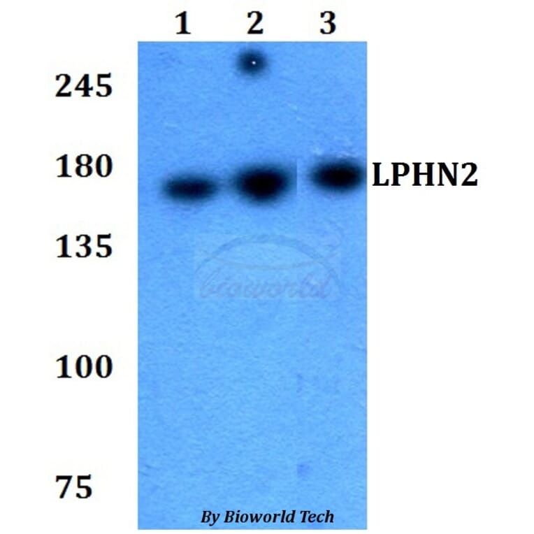 Anti-LPHN2 Antibody from Bioworld Technology (BS60779) - Antibodies.com