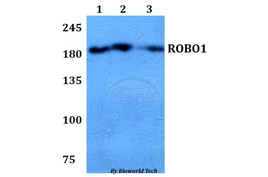Anti-ROBO1 Antibody from Bioworld Technology (BS60781) - Antibodies.com