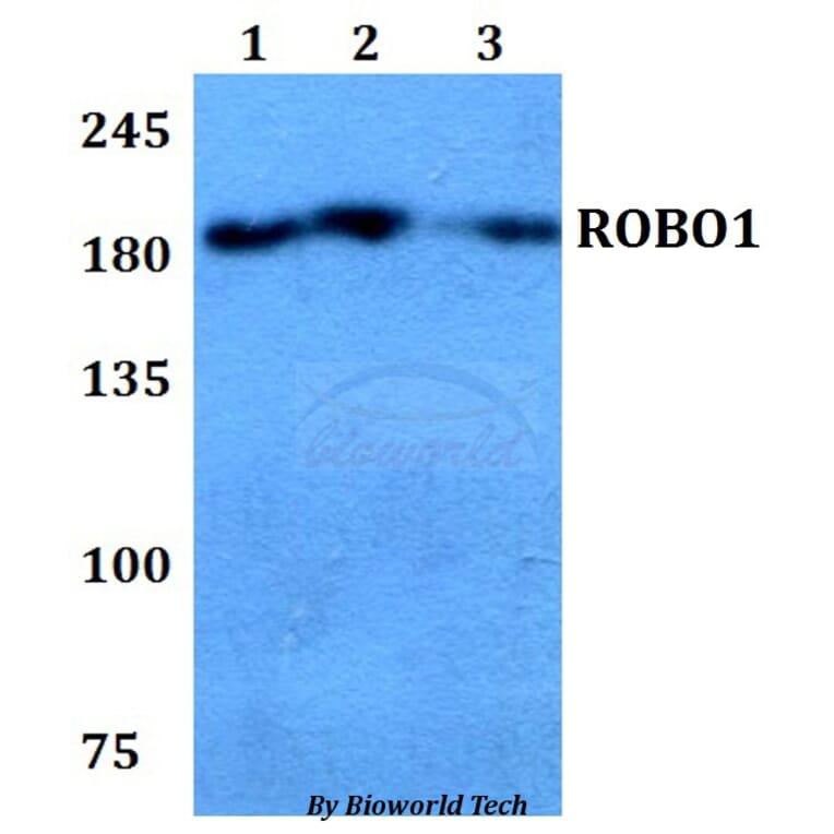 Anti-ROBO1 Antibody from Bioworld Technology (BS60781) - Antibodies.com