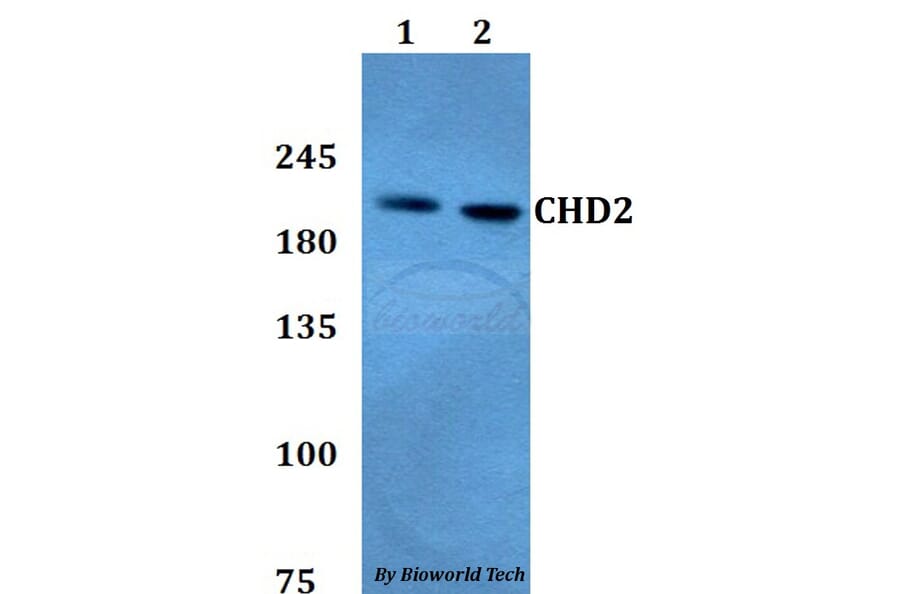 Anti-CHD2 Antibody from Bioworld Technology (BS60787) - Antibodies.com