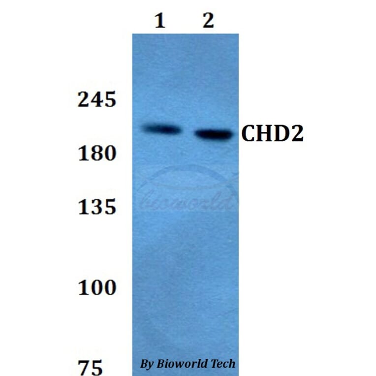 Anti-CHD2 Antibody from Bioworld Technology (BS60787) - Antibodies.com
