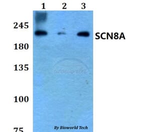 Anti-SCN8A Antibody from Bioworld Technology (BS60790) - Antibodies.com