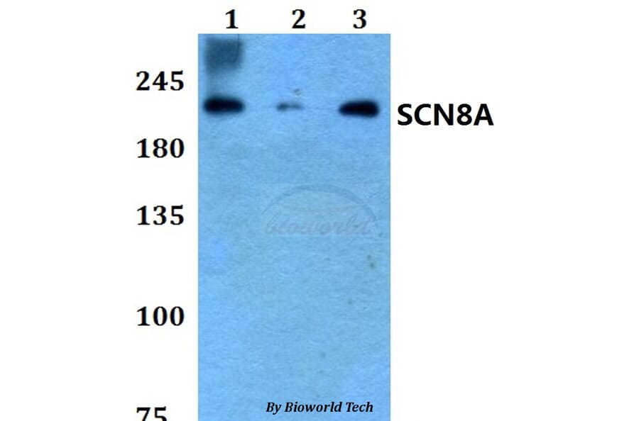 Anti-SCN8A Antibody from Bioworld Technology (BS60790) - Antibodies.com