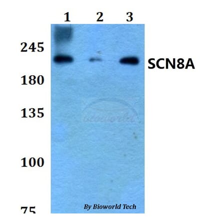 Anti-SCN8A Antibody from Bioworld Technology (BS60790) - Antibodies.com