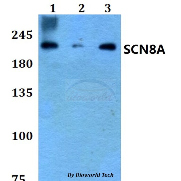 Anti-SCN8A Antibody from Bioworld Technology (BS60790) - Antibodies.com