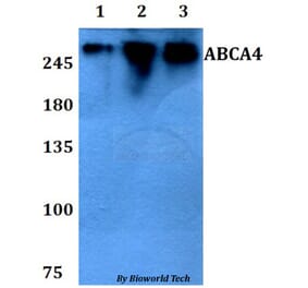 Anti-ABCA4 Antibody from Bioworld Technology (BS60799) - Antibodies.com