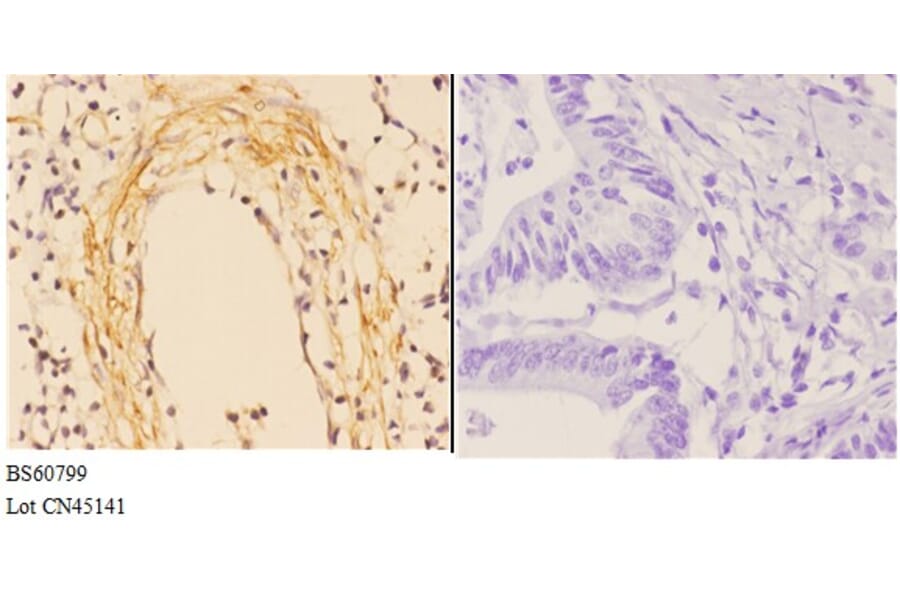 Anti-ABCA4 Antibody from Bioworld Technology (BS60799) - Antibodies.com