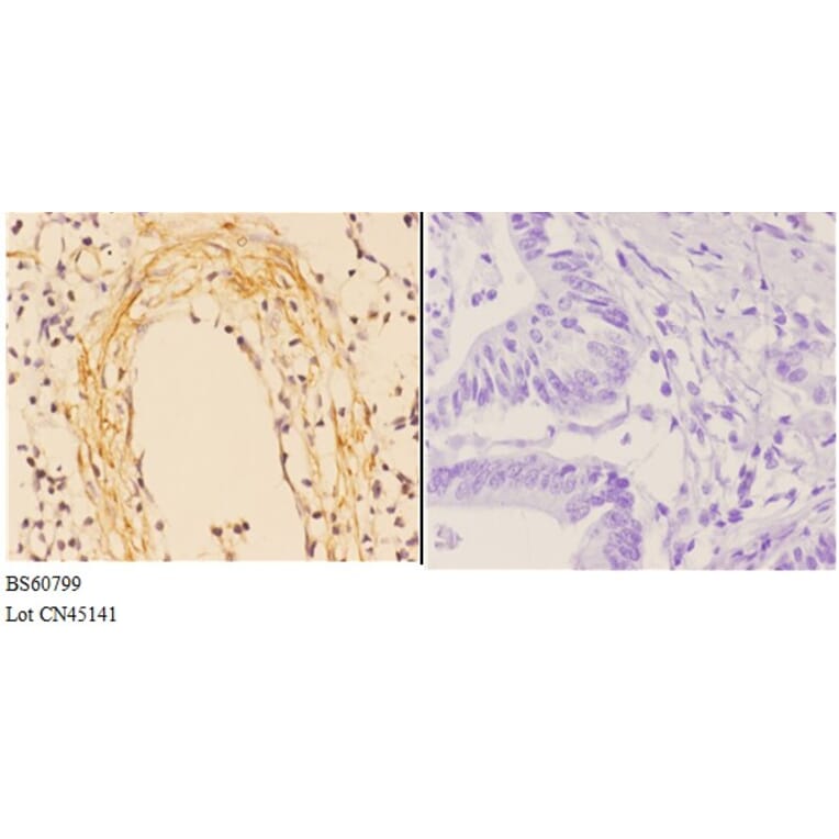 Anti-ABCA4 Antibody from Bioworld Technology (BS60799) - Antibodies.com