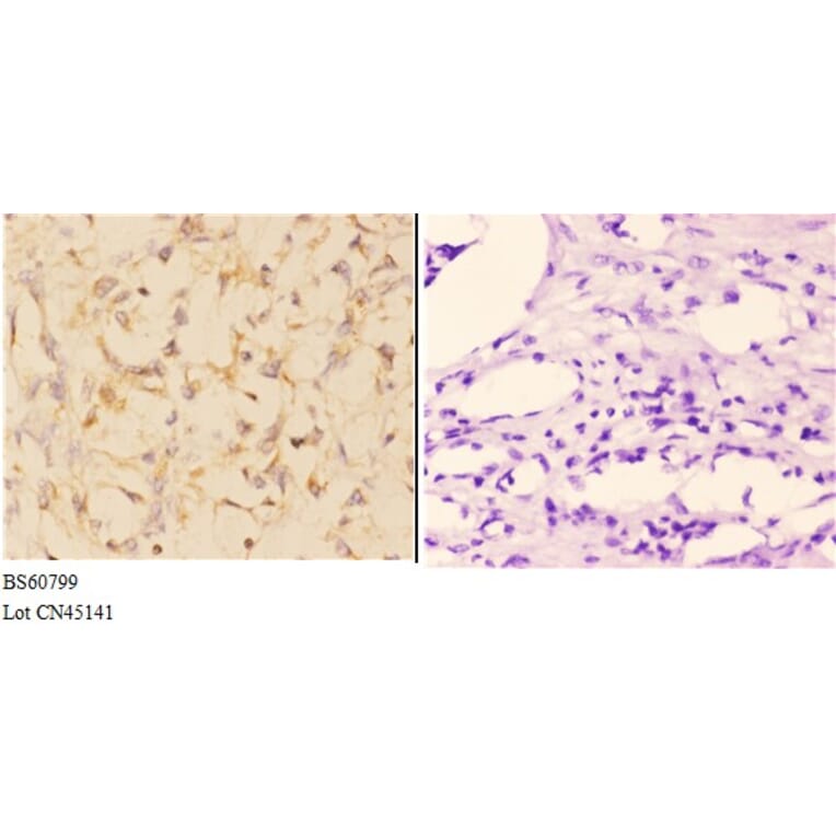 Anti-ABCA4 Antibody from Bioworld Technology (BS60799) - Antibodies.com