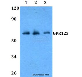 Anti-GPR123 Antibody from Bioworld Technology (BS60806) - Antibodies.com