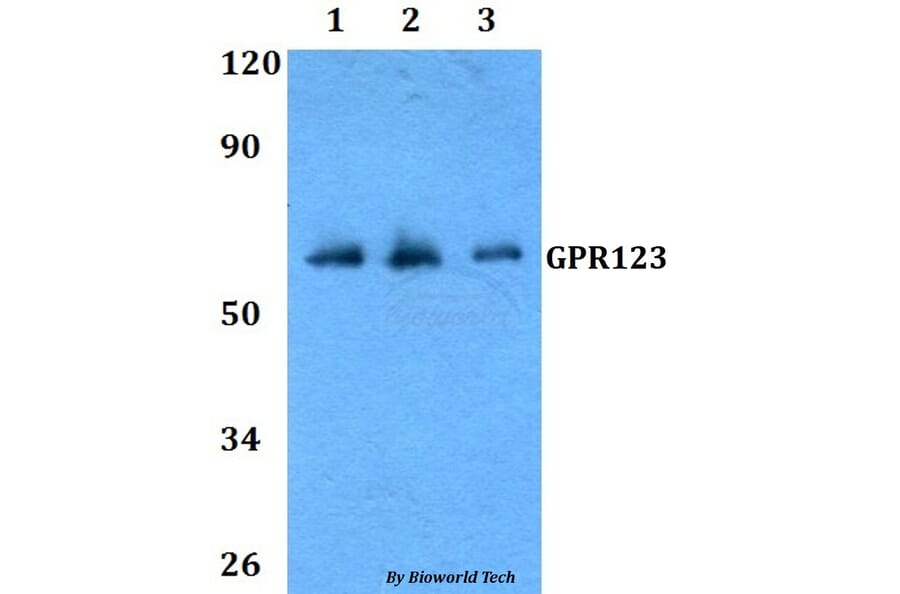 Anti-GPR123 Antibody from Bioworld Technology (BS60806) - Antibodies.com