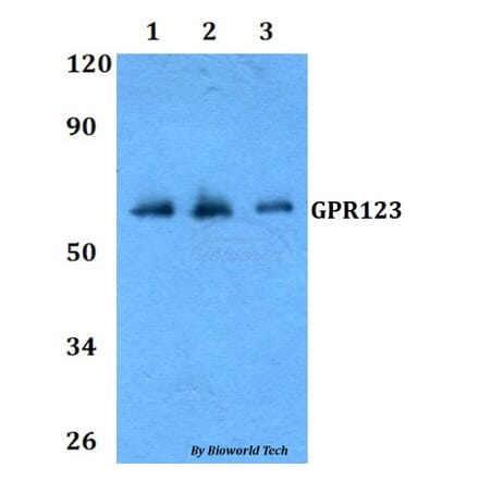 Anti-GPR123 Antibody from Bioworld Technology (BS60806) - Antibodies.com
