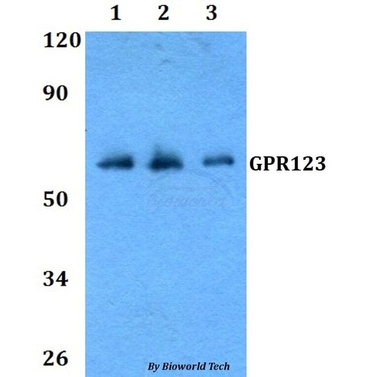 Anti-GPR123 Antibody from Bioworld Technology (BS60806) - Antibodies.com