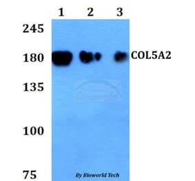 Anti-COL5A2 Antibody from Bioworld Technology (BS60811) - Antibodies.com