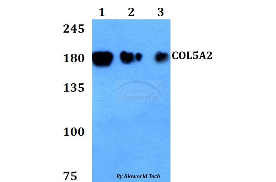 Anti-COL5A2 Antibody from Bioworld Technology (BS60811) - Antibodies.com