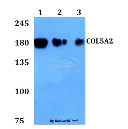 Anti-COL5A2 Antibody from Bioworld Technology (BS60811) - Antibodies.com