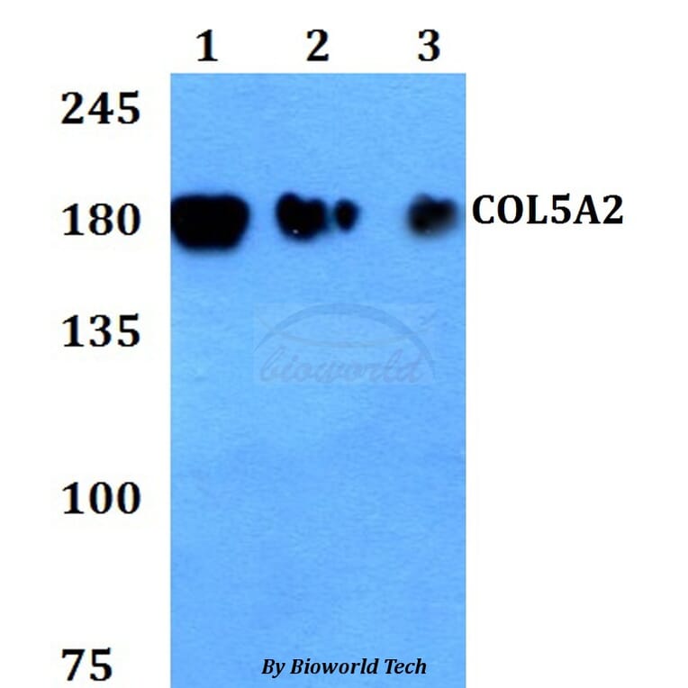 Anti-COL5A2 Antibody from Bioworld Technology (BS60811) - Antibodies.com