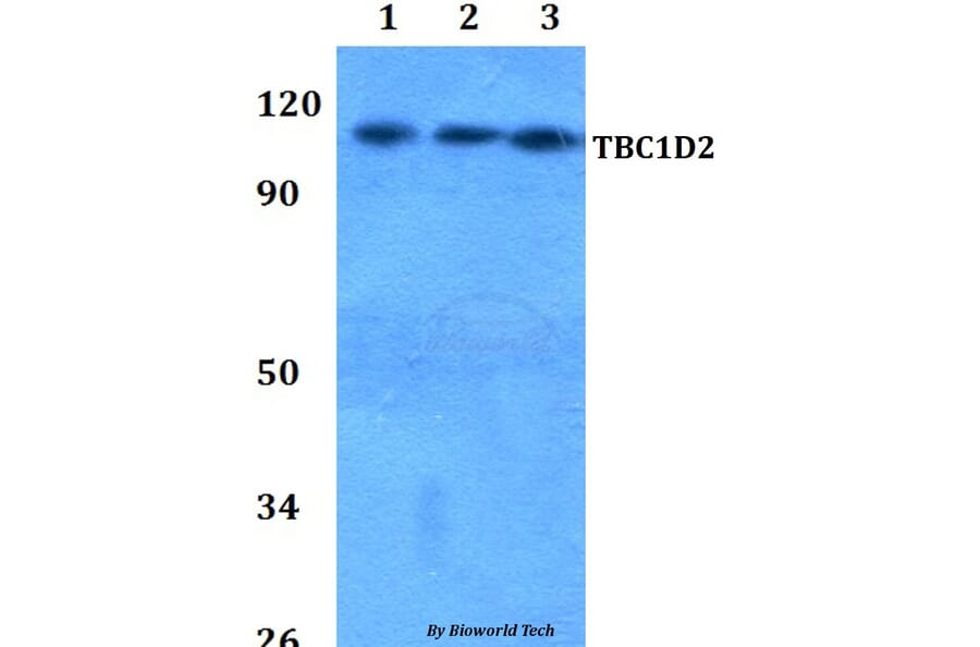 Anti-TBC1D2 Antibody from Bioworld Technology (BS60814) - Antibodies.com